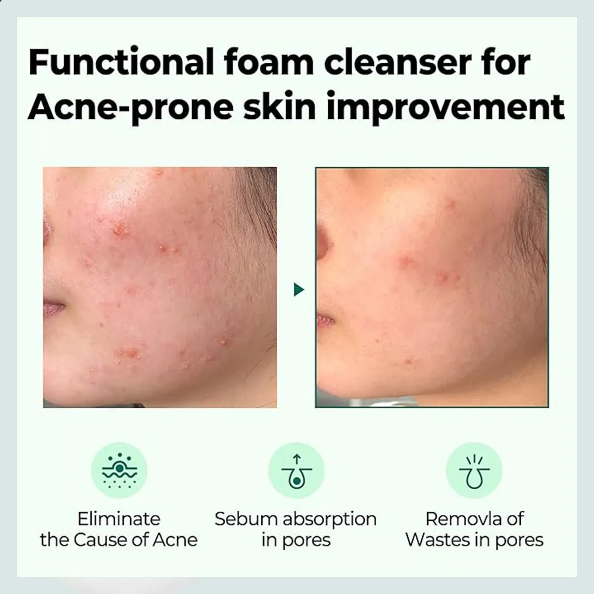Some By Mi Aha Bha Pha 30Days Miracle Acne Clear Foam 100Ml